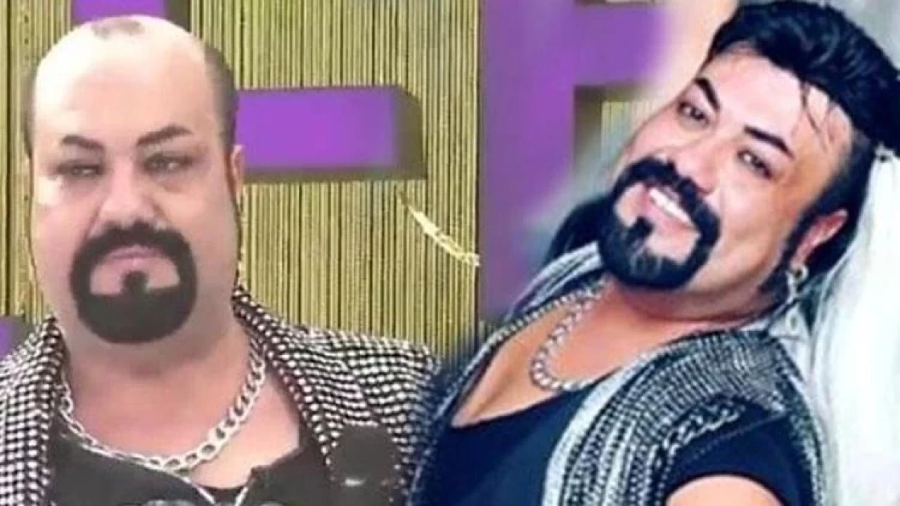 Kobra Murat kel mi, saçı peruk mu, protez saç mı kullanıyor?