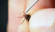 Çorumda kene ısırması sonucu bir kişi hayatını kaybetti