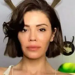 Didem Ceren Kimdir ve Güney Kore’de Yüz Nakli Mi Oldu?