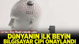 Çin'den Beyin Bilgisayar Arayüzünde Kritik Hamle