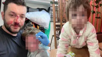 Yalova'da Baba ve Kızına Saldırı: Ceza İstemi Belli Oldu!