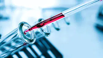 MPV Nedir? MPV yüksekliği ve düşüklüğü ne anlama gelir?