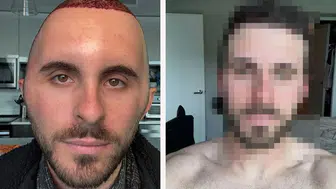İngiliz turistin Türkiye macerası sosyal medyayı salladı: Yeni görüntüsü herkesi şaşırttı