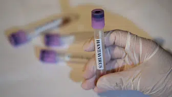 Lüks gemide kabus bitmiyor: Hantavirüs vakalarında kritik uyarı