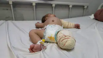 Gazze saldırısında ağır yaralanan bebek için kritik süreç