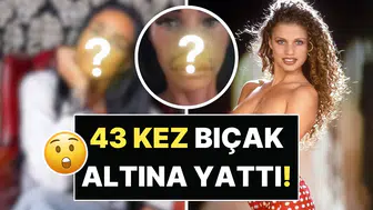 Katie Price Estetik Operasyonlarla Geçirdiği Değişimle Gündemde