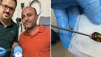 Kulağındaki ağrının sebebi tarım alanında girdiği bir böcek çıktı