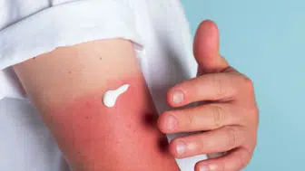 Yüksek sıcaklıklar kapıda uzmanlar güneş kremi seçiminde uyardı
