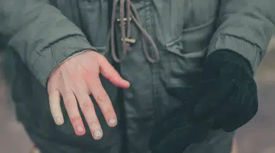 Raynaud Fenomeni (Hastalığı) Nedir? Parmak Uçlarında Beyazlama ve Üşüme Neden Olur? Belirtileri, Testi ve Tedavisi