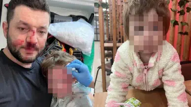 Yalova'da Baba ve Kızına Saldırı: Ceza İstemi Belli Oldu!