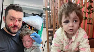 Yalova'da Gürültü Tartışması, Babanın Sopalı Saldırısına Dönüştü!