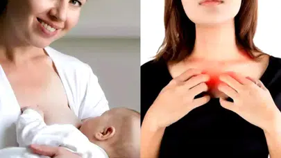 Doktorlara Göre Göğüslerinizin Kaşınmasının 16 Nedeni