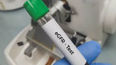 EGFR (GFR) nedir? EGFR düşüklüğü ve yüksekliği ne anlama gelir?