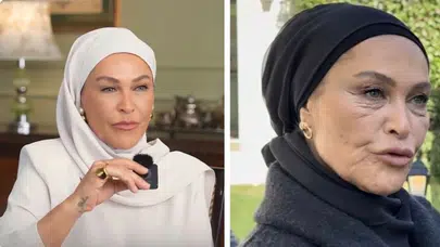 Hülya Avşar’a televizyonda filtre uygulanıyor mu?