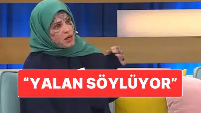 Yüzü Dövmeli Nazan Ünal Kimdir, Neden Gündem Oldu?