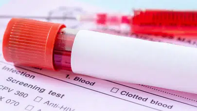 Üçlü Tarama Testi: Nedir ve Nasıl Uygulanır? İşte Bilimsel Temelleri