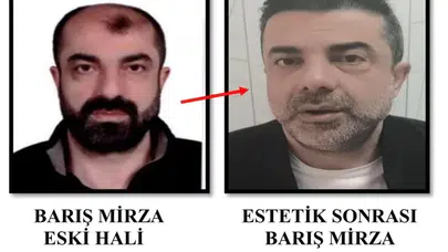 Firari Cinayet Zanlısı, Ameliyatla Yüz Değiştirip 7 Yıl Sonra Türkiye’ye Döndü ve Polisi Başına Çağırdı