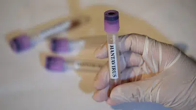 Lüks gemide kabus bitmiyor: Hantavirüs vakalarında kritik uyarı