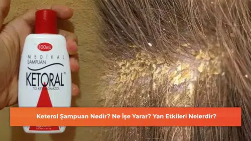 Keterol Şampuan Hakkında Bilinmesi Gerekenler: İşlevleri ve Olası Yan Etkileri