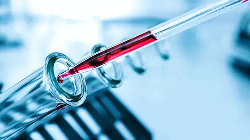 MPV Nedir? MPV yüksekliği ve düşüklüğü ne anlama gelir?