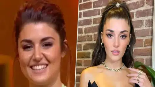 Hande Erçel Estetik Operasyonları: Burnu ve Diğer Uygulamalar Hakkında Uzman Görüşleri
