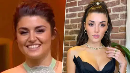 Hande Erçel'in Estetik Üzerindeki Sır Perdesi: Burnunda Değişiklik Mi Var?