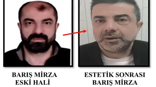 Firari Cinayet Zanlısı, Ameliyatla Yüz Değiştirip 7 Yıl Sonra Türkiye’ye Döndü ve Polisi Başına Çağırdı