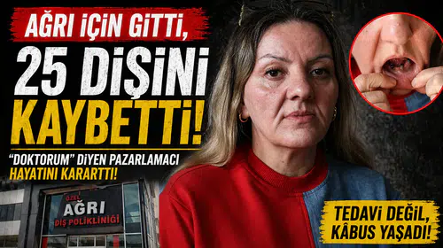 Ağrıların tedavisi için başvurdu, 25 dişini kaybetti: 'Doktorum' diyen dolandırıcı hayatını altüst etti!