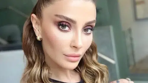 Özge Ulusoy'dan Estetik Operasyonlar ve Podyum Hayatı Üzerine Çarpıcı Açıklamalar!