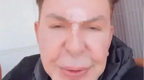 Kuşum Aydın, Estetik Değişimle Geçmişini Geride Bıraktı! İşte Şaşırtan Dönüşüm Hikayesi!