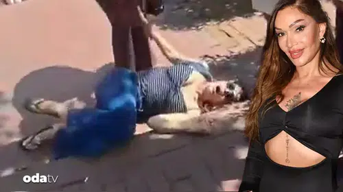 Keyifli bir gün yerini kabusa bıraktı: Sevda Demirel Maçka Parkı'nda hastanelik oldu