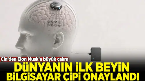 Çin'den Beyin Bilgisayar Arayüzünde Kritik Hamle