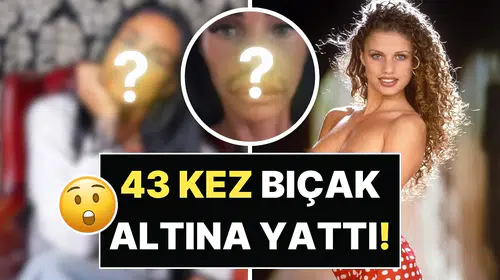 Katie Price Estetik Operasyonlarla Geçirdiği Değişimle Gündemde
