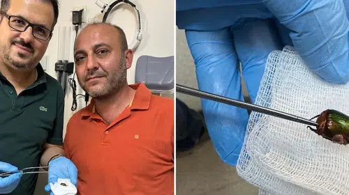 Kulağındaki ağrının sebebi tarım alanında girdiği bir böcek çıktı