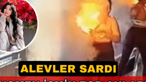 Taşınabilir şarj cihazı patlaması sosyal medya fenomenini yaraladı