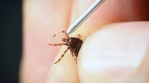 Çorumda kene ısırması sonucu bir kişi hayatını kaybetti