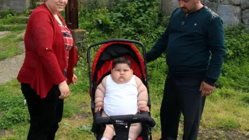 90 kilodan sağlıklı günlere: Yağız’ın mucizevi değişimi