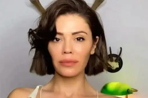 Didem Ceren Kimdir ve Güney Kore’de Yüz Nakli Mi Oldu?