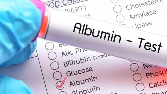 Albümin: Vücut Sağlığının Göstergesi ve Anlamı