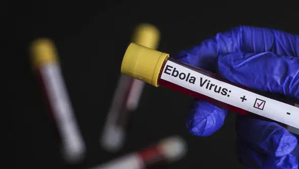 Belçika’da Ebola alarmı: Sağlık birimleri olası vakalar için hazırlıklarını tamamladı