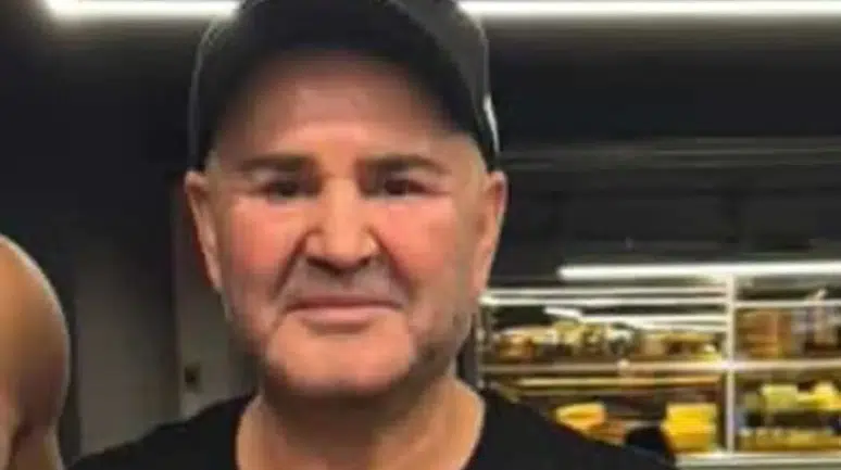 Estetik Operasyonlarla Değişime Uğrayan İsim: Tanınmaz Hale Geldi!