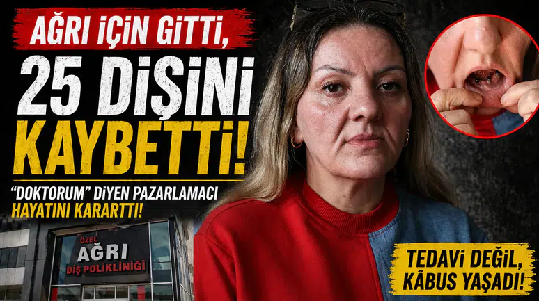 Ağrıların tedavisi için başvurdu, 25 dişini kaybetti: 'Doktorum' diyen dolandırıcı hayatını altüst etti!