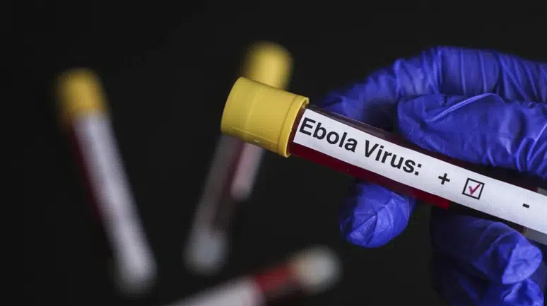 Belçika’da Ebola alarmı: Sağlık birimleri olası vakalar için hazırlıklarını tamamladı