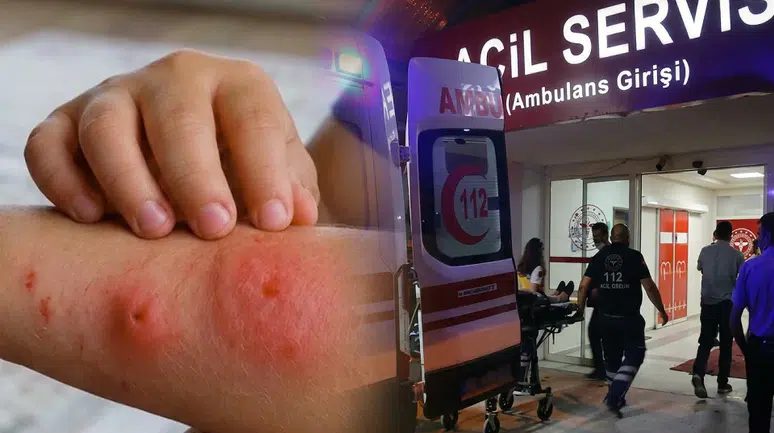 Asya Kaplan Sivrisineği Tehdidi ve Çocuklarda İltihap Riski